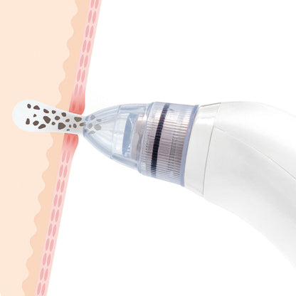 Dispositivo Eléctrico de Limpieza Facial y Eliminación de Puntos Negros Pore·Off de InnovaGoods